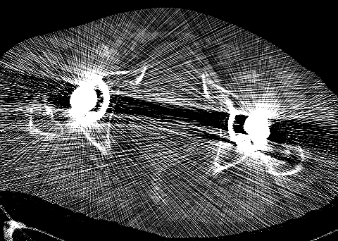 Артефакты кт изображений