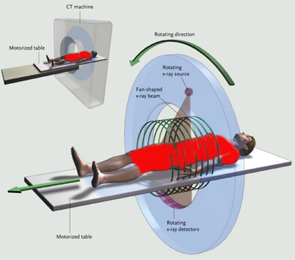 Для получения изображения в компьютерной томографии используется