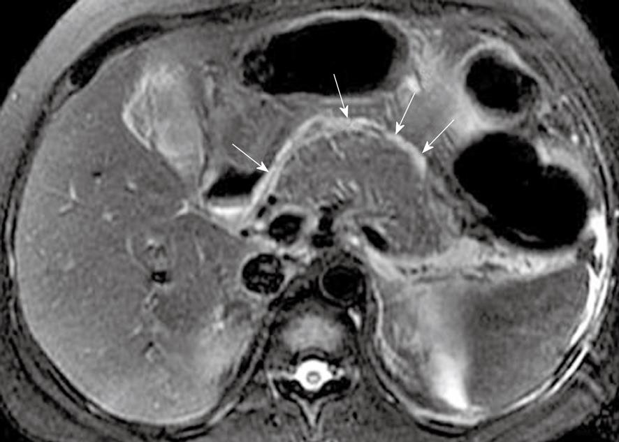 Рентген поджелудочной железы подготовка thumbnail