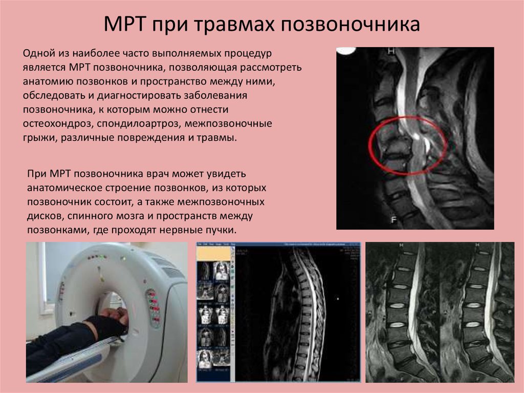 Магнитно-резонансная и компьютерная томография позвоночника